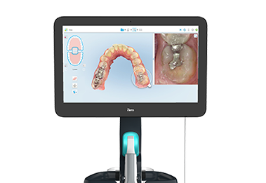 デジタル光学印象採得装置口腔内スキャナー（iTero）