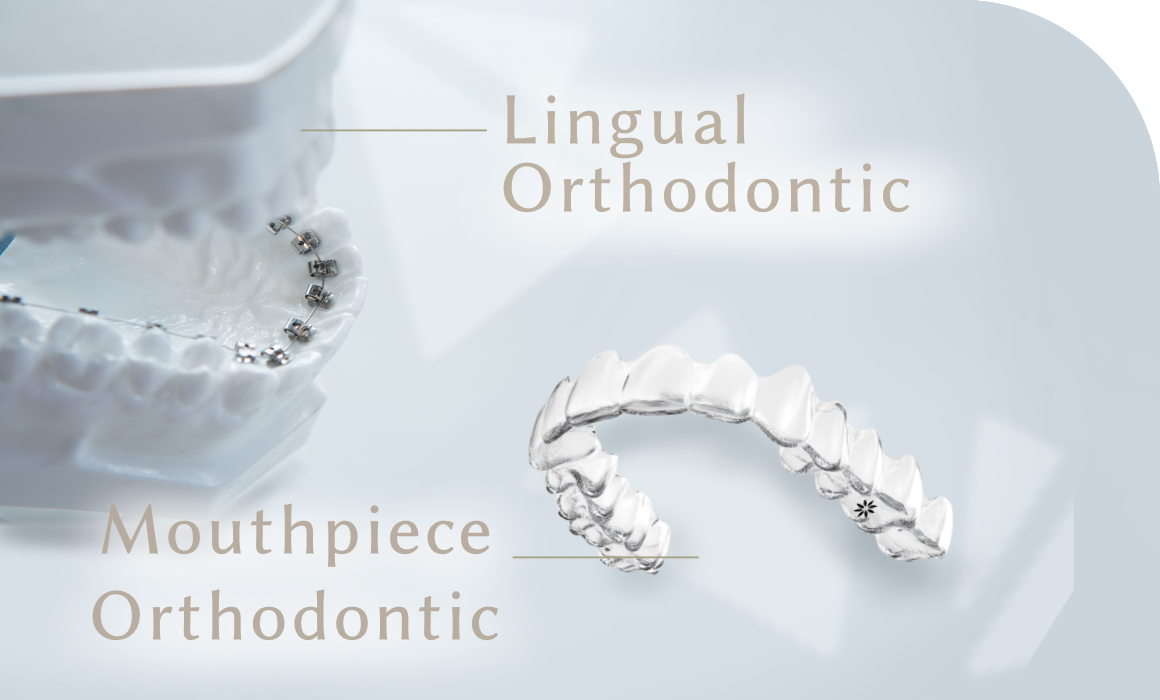 唇側矯正・舌側矯正・マウスピース型矯正装置・子供の矯正に対応