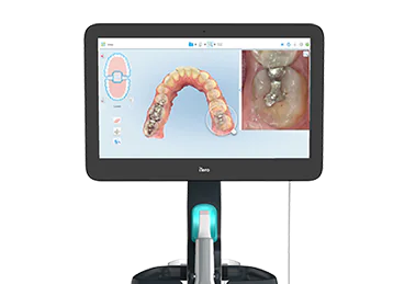 光学印象採得装置 iTero(アイテロ)